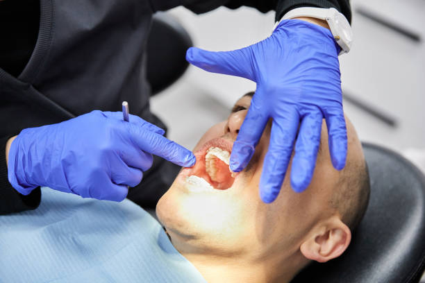 Best Emergency Wisdom Teeth Removal in Hockinson, WA